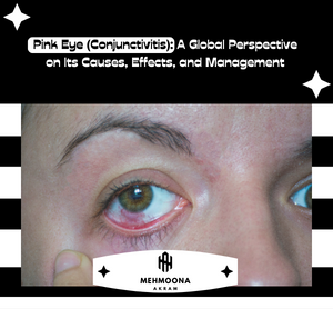 A global perspective on pink eye's cause, effects, and management - an informative image